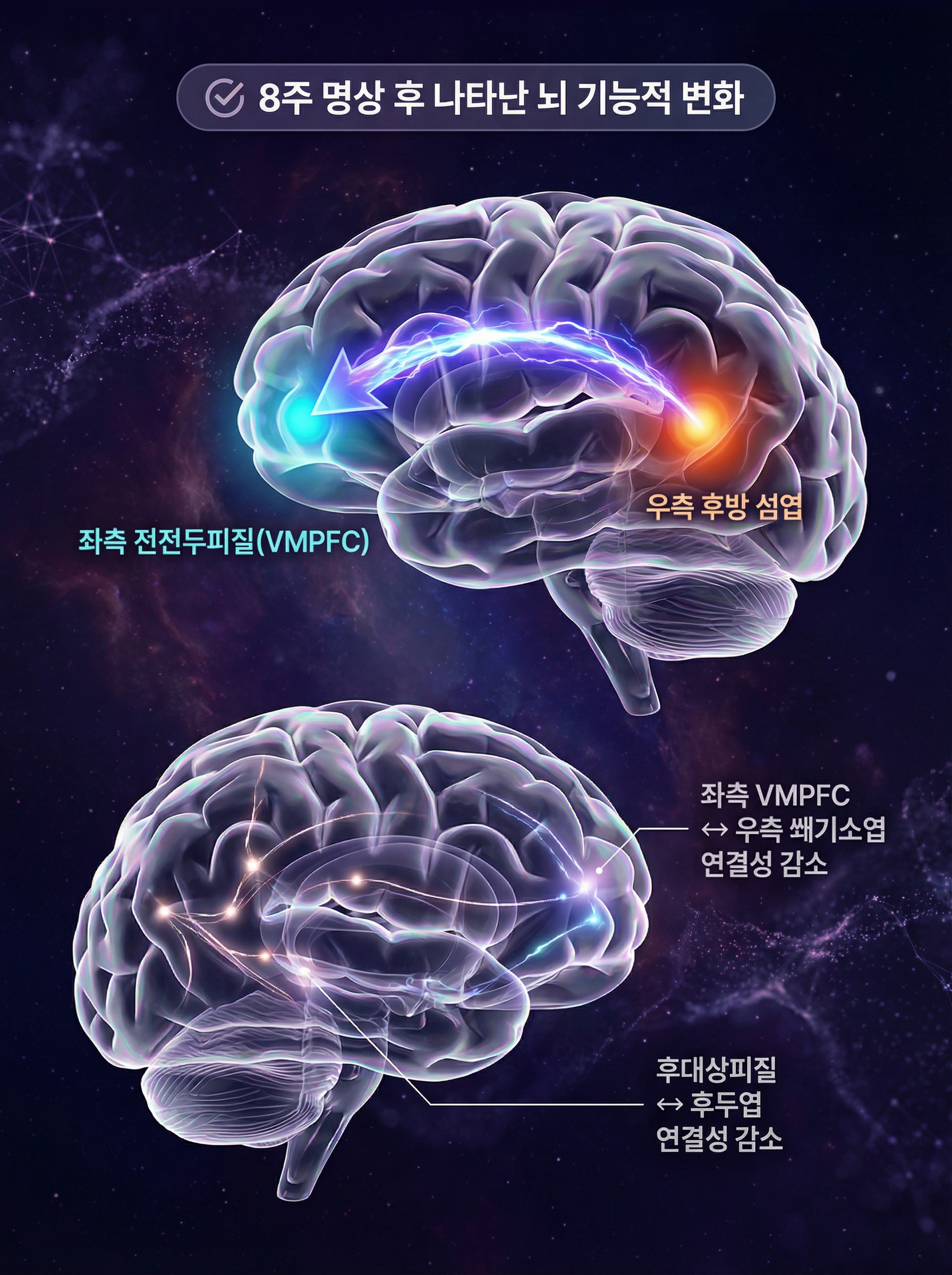 뇌과학fmri.jpg